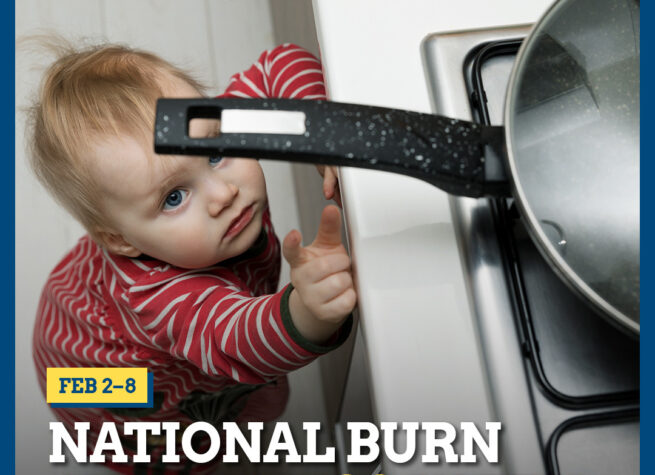 Burn Awareness: Prevention and Care